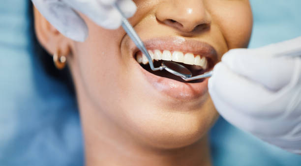 Best Emergency Dental Care for Broken or Chipped Teeth in Theresa, WI