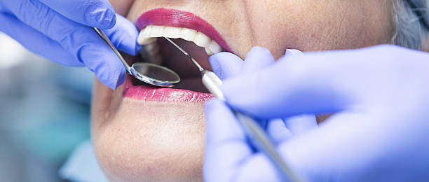 Best Emergency Wisdom Teeth Removal in Theresa, WI